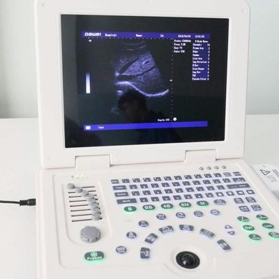 quality GYN Factory Supply Dw580 Portable Ultrasound Machine For Sale factory