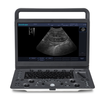 New Veterinarian Ultrasound Machine Sonoscape E1V Medical Medical Sheep Portable Ultrasound