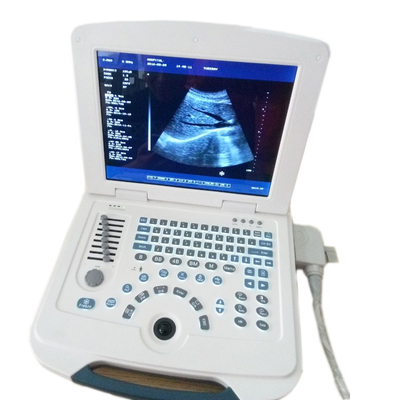 Steel Easy Operation Multilingual Portable Ultrasound Machine