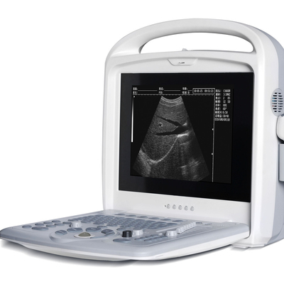 Cheap Portable Human Metal Ultrasound Medical Instruments Digital Ultrasound Machine
