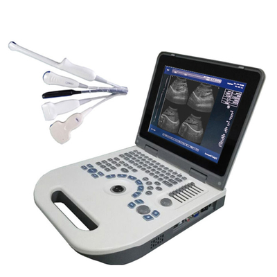 Metal CE Approved Best Price Ultrasound Machine Price 12.1 Inch LED Laptop, Laptop BW Ultrasound Scanner