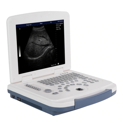 Hospital B/W Ultrasound Machine Laptop Portable Ultrasound Scanner